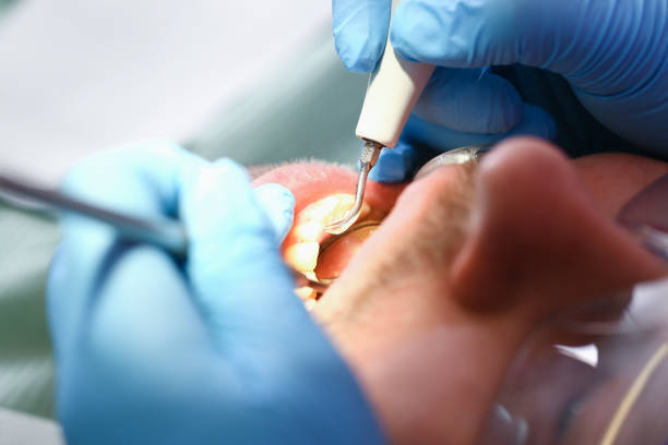 Best Same-Day Emergency Dentist in Pine Bluff, AR