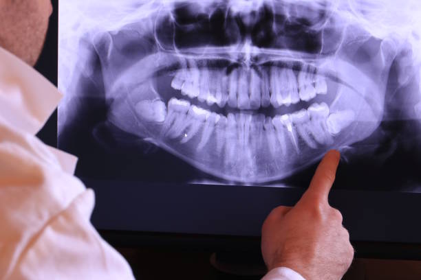 Best Emergency Tooth Extraction in Pine Bluff, AR